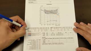 How to Read Your Hearing Test [upl. by Llehcal]