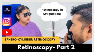 Retinoscopy Part 2  Static Retinoscopy for astigmatism  SpheroCylinder method [upl. by Mar]