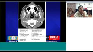 Maxillofacial CT anatomy by Dr Geetha Balasubramaniam [upl. by Ailsa]