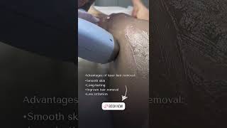 Laser Hair Removal [upl. by Wenonah]