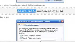 Tutorial DNS Einstellung ändern bei Vista [upl. by Lupee795]