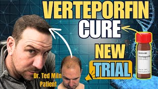 Verteporfin Hair Loss Cure Trial To Start 2025 Dr Ted Miln UK [upl. by Assyn702]