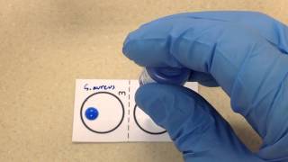 Microbiology  Coagulase [upl. by Gae]