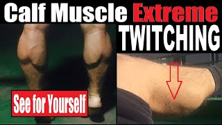 Calf Muscles Twitching after Hard ExerciseFatigue How to Treat Twitching Calves and other Muscles [upl. by Atirma155]