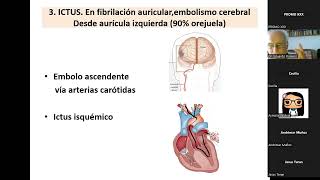 FÁRMACOS ANTIAGREGANTES PLAQUETARIOS  Dr Eduardo Romero [upl. by Harlin]