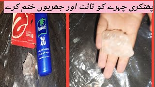 alum  phitkari face ko tight karephitkari use and benefits  phitkari k amazing uses [upl. by Austine]