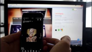 LinkCloud Mobile dicom viewer [upl. by Grosmark333]