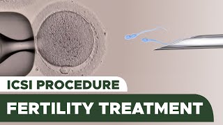 Fertility Treatment Intracytoplasmic Sperm Injection ICSI Procedure [upl. by Laetitia]