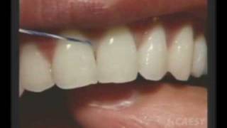 Dentist  Dental floss  Hygiene Dentist  Burbank  Dr Sa [upl. by Okimat]