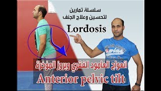 انعواج العامود الفقري وبروز المؤخرة Anterior pelvic tilt Lordosis [upl. by Picco606]