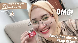 REVIEW POND’s AGE MIRACLE kemasan baru HEXYL RETINOL  Anti Aging Cream [upl. by Kiona576]