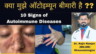 क्या मुझे ऑटोइम्यून बीमारी है   ये लक्षण कभी ना करें नज़रअंदाज़  Signs of Autoimmune Diseases [upl. by Eiddal]