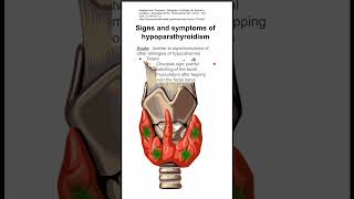 Signs and symptoms of hypoparathyroidism [upl. by Anirroc]