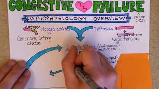 Heart Failure  Cardiac Pathology [upl. by Ihcekn860]