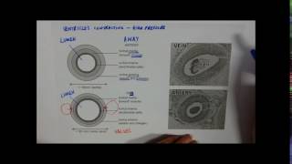 Arteries veins and capillaries [upl. by Tammara736]