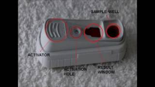 Final Video Laboratory diagnosis of Leptospirosis in dogs [upl. by Adnilak]