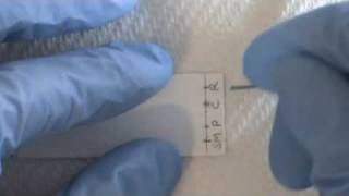 Thin Layer Chromatography  TLC [upl. by Ecirtap843]