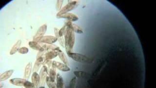 Paramecium Under the Microscope [upl. by Tamar]