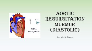 Aortic regurgitation murmur and its mechanism [upl. by Nelyt618]