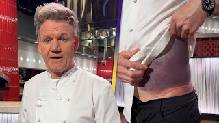 Gordon Ramsay Feels Lucky After Bike Crash Leaves Him Badly BRUISED [upl. by Aube]