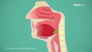 Dysphagie troubles de la déglutition et Fausse route questce que cest [upl. by Vesta]