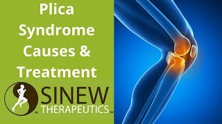 Plica Syndrome Causes and Treatment [upl. by Tomkiel]