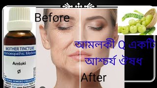 আশ্চর্য একটি হোমিওপ্যাথি ঔষধ আমলকি  Amalaki Q  Embelica Officinalis Q homeopathic medicine uses [upl. by Geis222]