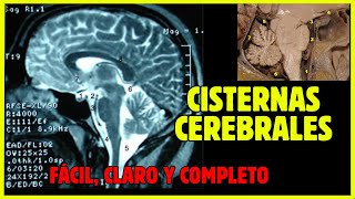 🧠 CISTERNAS CEREBRALES  Anatomía de las cisternas subaracnoideas fácil y completo [upl. by Lathrope]