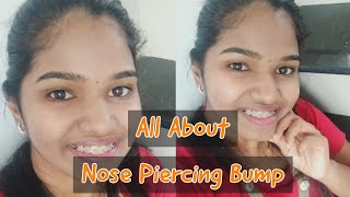 All About Nose Piercing Bump  Explained  Malayalam [upl. by Enael]