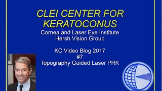 CLEI Center For Keratoconus  TopographyGuided PRK for Keratoconus  Episode 7 [upl. by Atsylak]