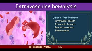 Lecture 212 Intravascular hemolysis [upl. by Keefer]