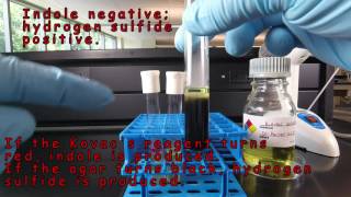 SIM Medium Detection of Indole and Hydrogen Sulfide Production [upl. by Mikaela]